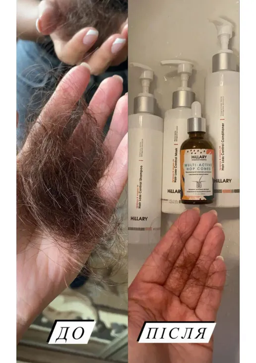 Шампунь проти випадіння волосся Serenoa & РР Hair Loss Control Shampoo - фото 4